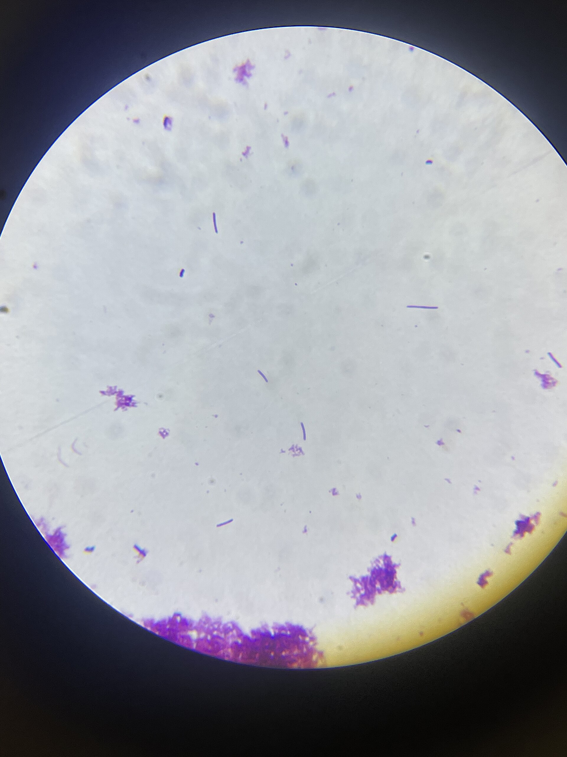 Бактерията Lactobacillus bulgaricus под микроскоп